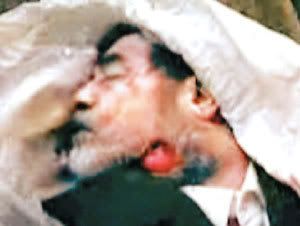saddam-injury.jpg