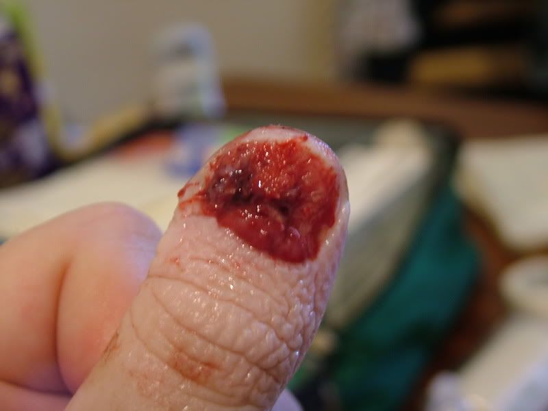 Bad Knife Cuts